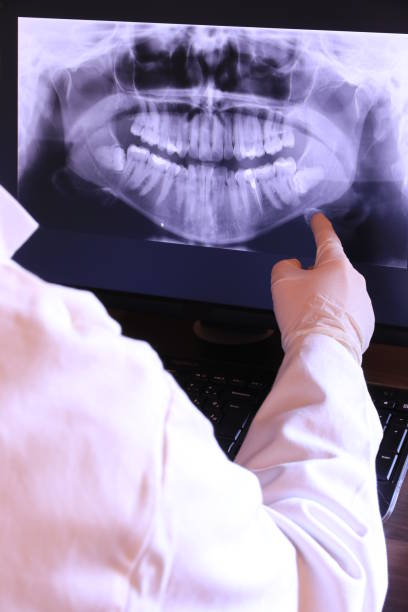 Best Emergency Dental Care for Abscessed Tooth in Jasmine Estates, FL