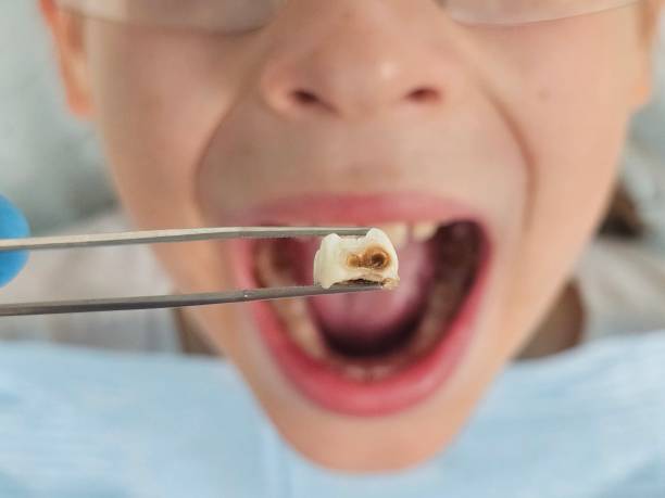Best Orthodontic Emergency Dentist in Jasmine Estates, FL